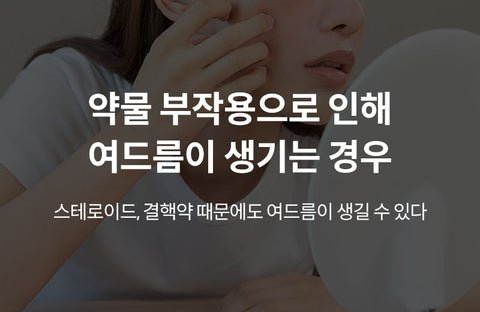 Acne can occur due to side effects of medicationsJung Jin-ho, Department of Dermatology, Seoul National University Hospital