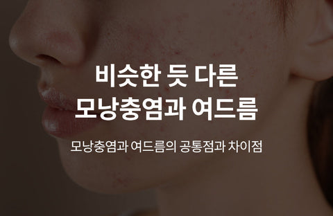 Similar to other folliculitis and acne, the differences and how to treat themDermatologist Jaewi Cho