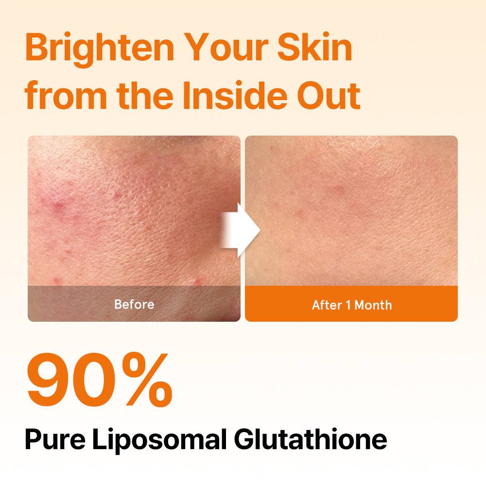 lyuh esther glutathione direct 5x before and after FORMULA Liposomal Strips (30ct) Choose Location:Queens in office