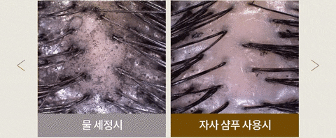 ESTHER FORMULA Hair Care ESTNU Brewer's Yeast Biotin Anti-Hair Loss Shampoo Korean Beauty